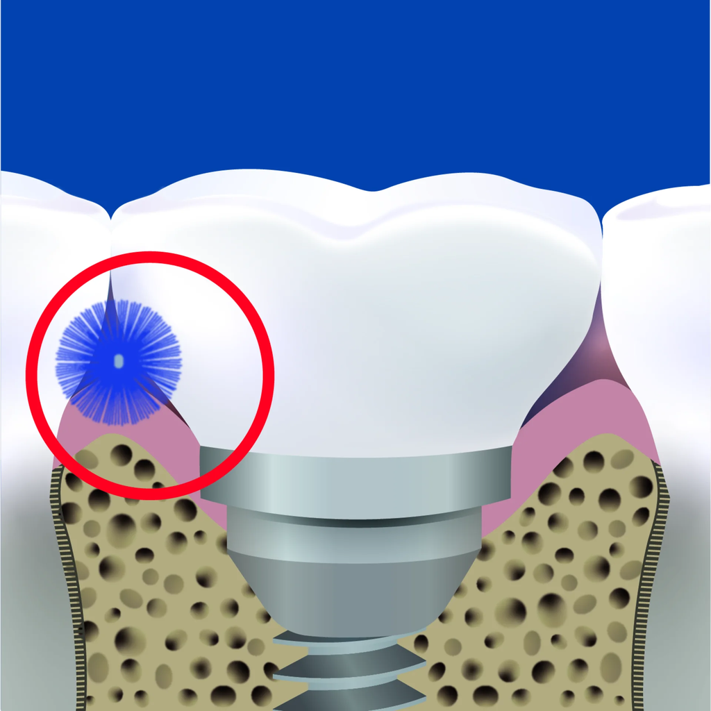 solo-med_2404-2409_zaehne-mit-solo-stix-i-03.webp